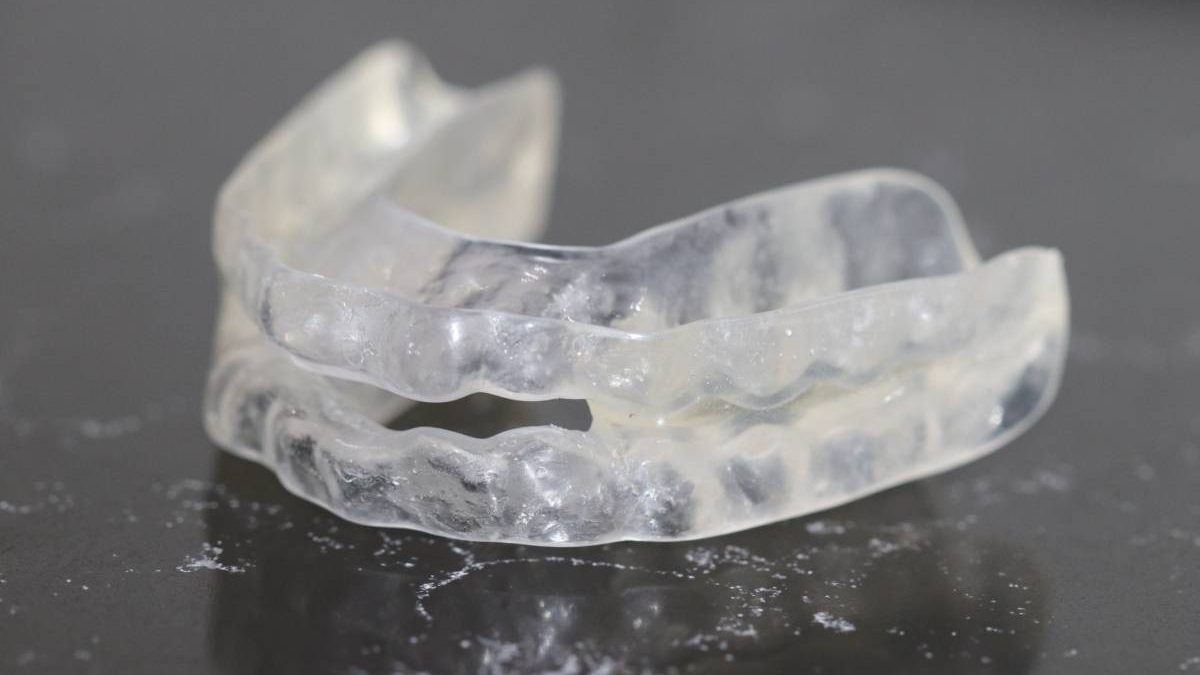 Aparat dentar invizibil: ce te așteaptă la început