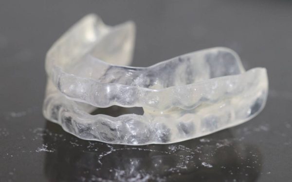 Aparat dentar invizibil: ce te așteaptă la început